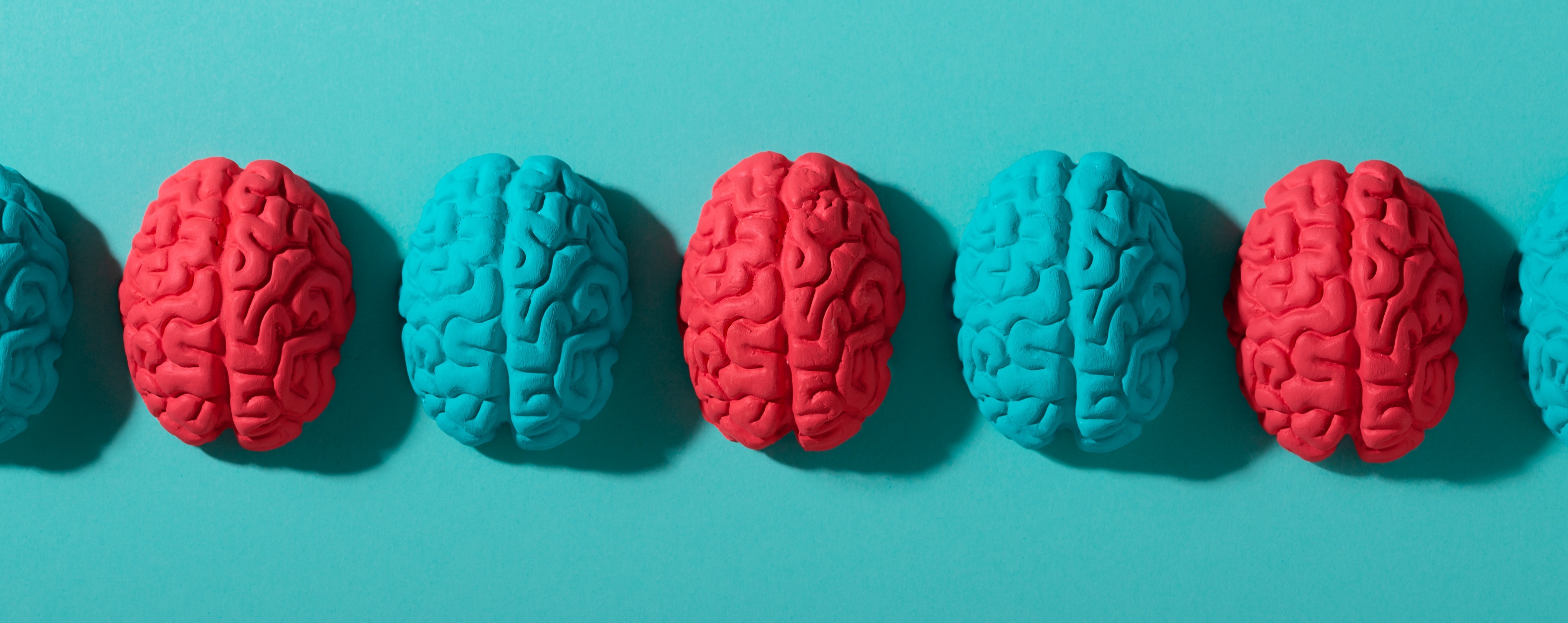 Neurodiversité : Le nouvel avantage concurrentiel de votre capital humain